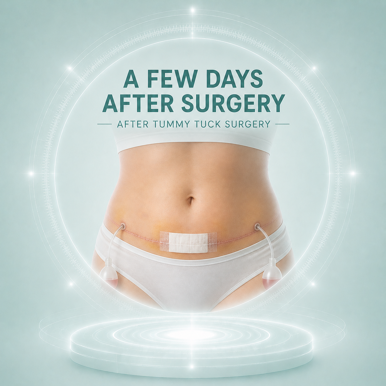 The First Few Days After Tummy Tuck Surgery
