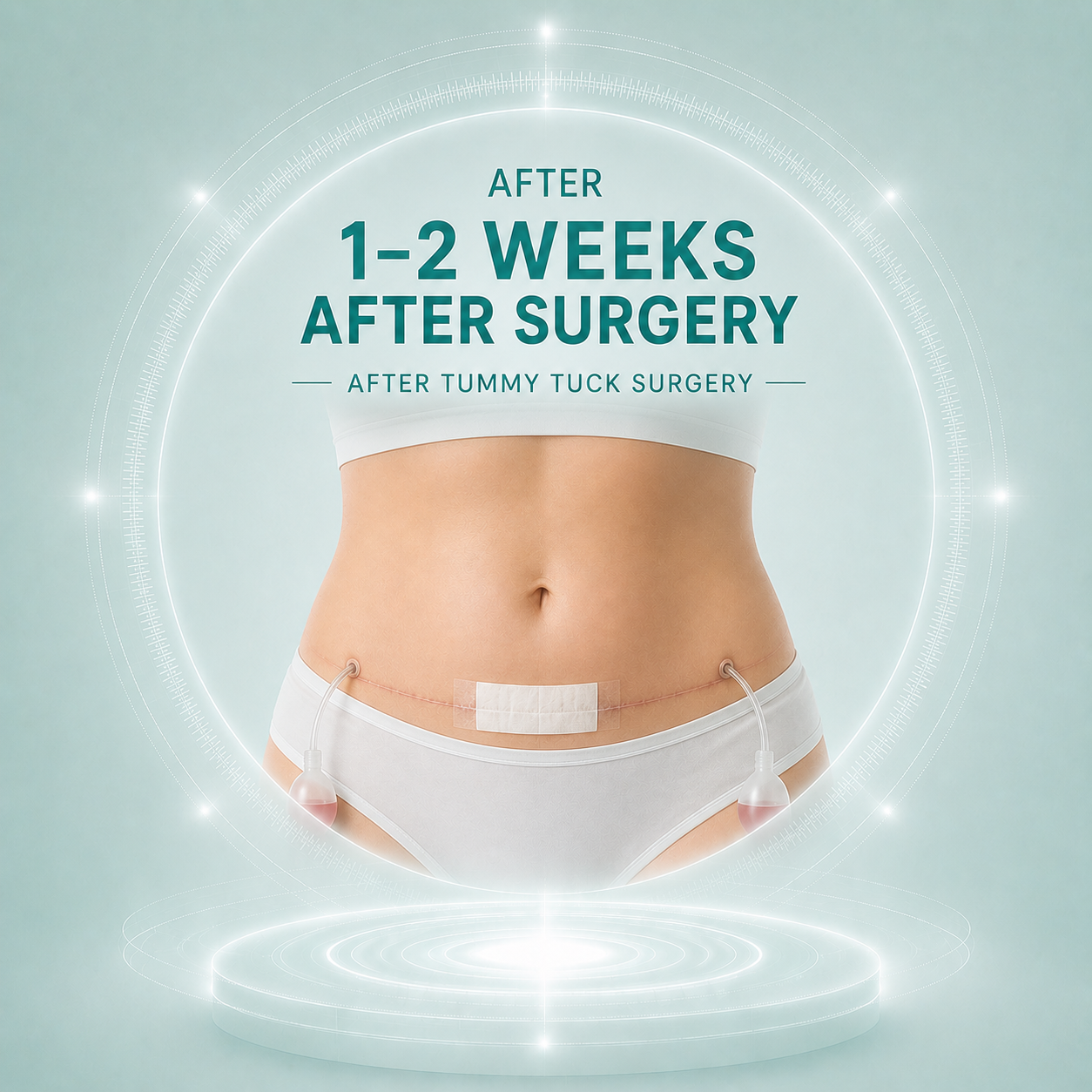 Weeks 1–2 After Tummy Tuck Surgery