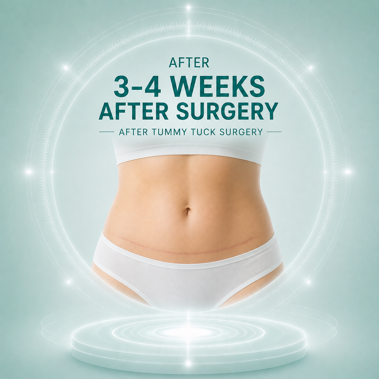 Weeks 3–4 After Tummy Tuck Surgery