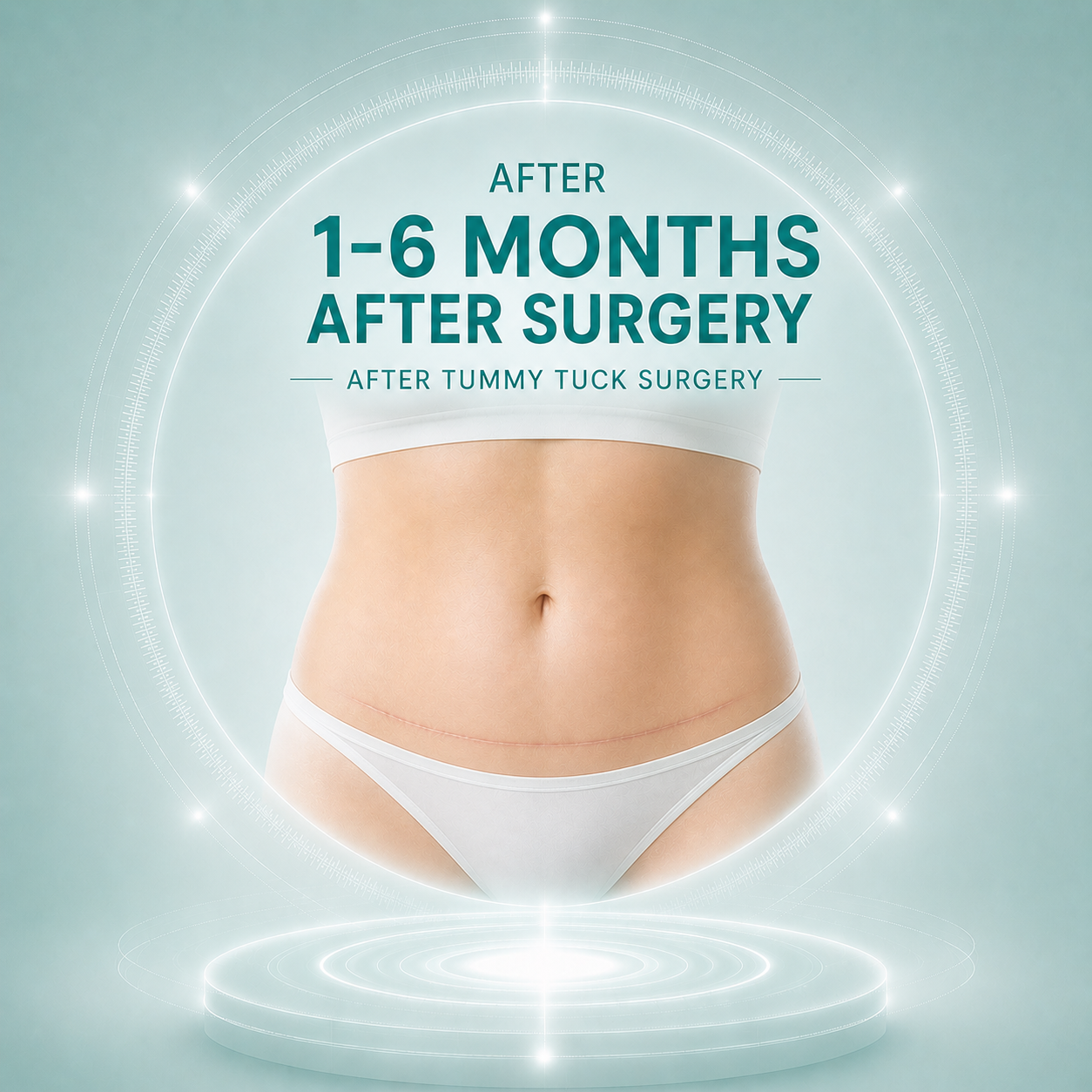 Months 1–6 After Tummy Tuck Surgery