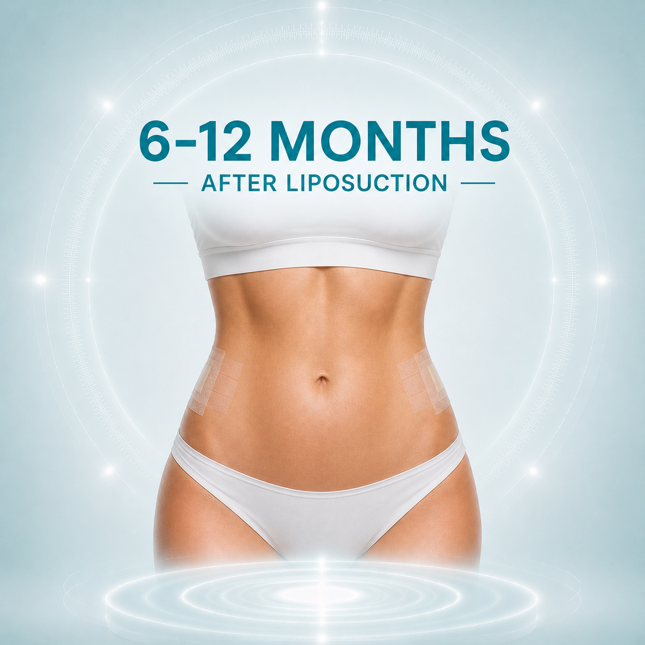 6–12 Months After Liposuction Surgery