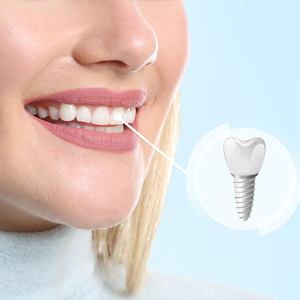 How it works
