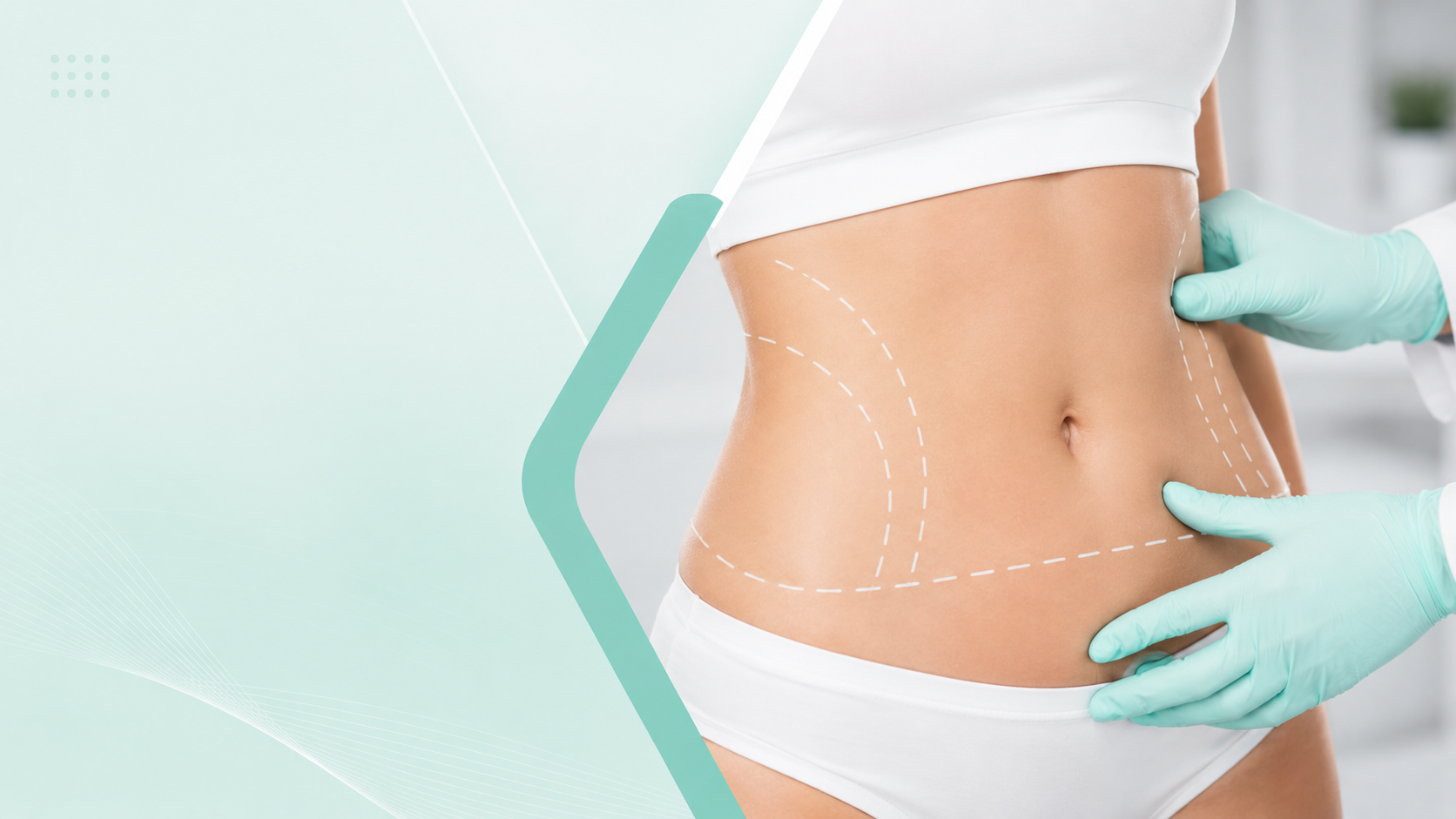 Liposuction Aftercare
